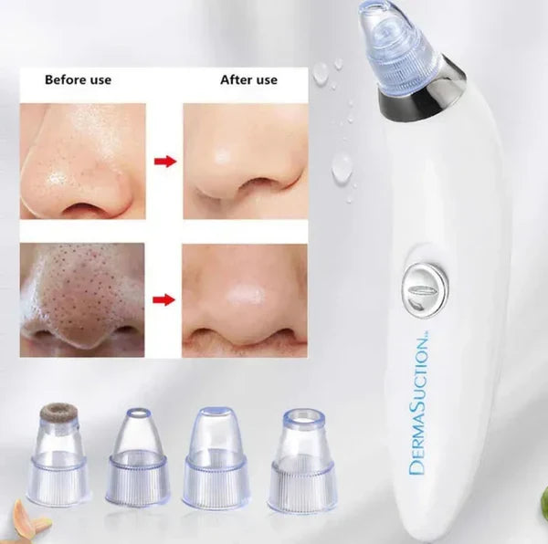 DermaGlow Suction Pro