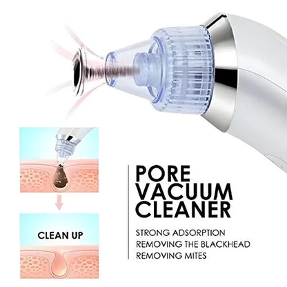 DermaGlow Suction Pro