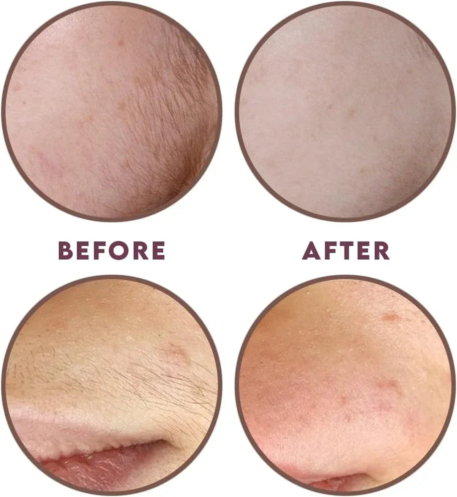 ThreadLux™ Hair Threading System – Smooth, Painless Face & Body Removal