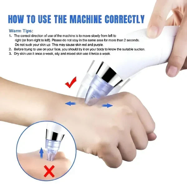 DermaGlow Suction Pro